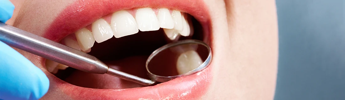 Dental Sealants in Auburn ME