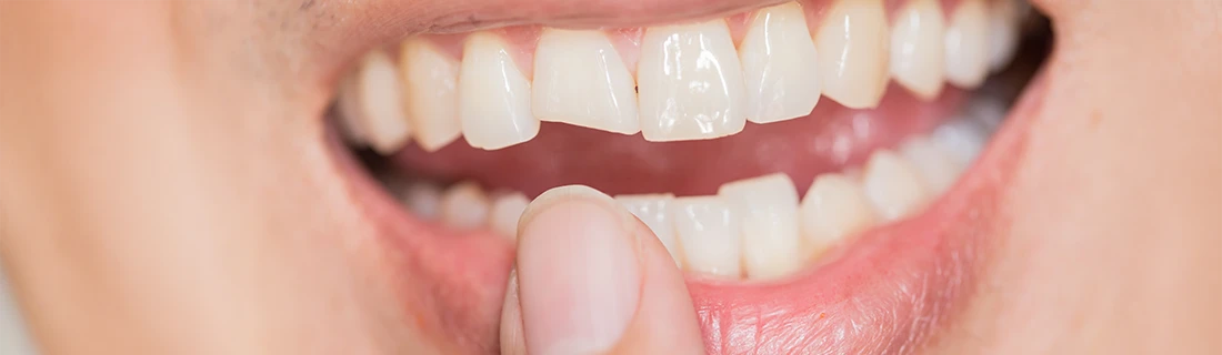 Emergency Dentistry in Auburn ME