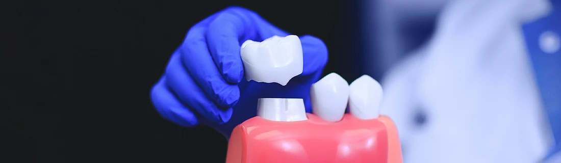 Dental Crowns In Auburn ME