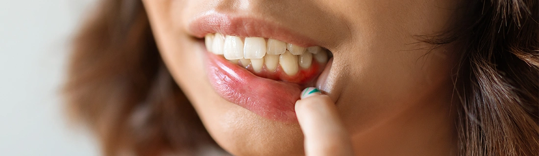 Oral Cancer Screenings in Auburn ME